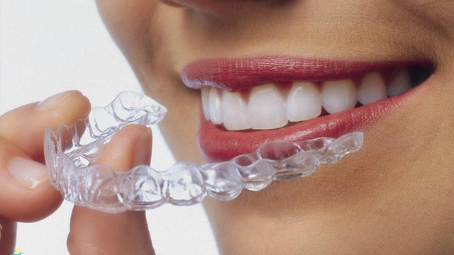 Khay Nieng Invisalign